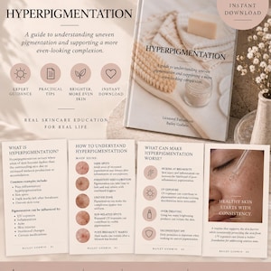 Hyperpigmentation Skin Care Guide | Dark Spots & Uneven Skin Tone Digital Download