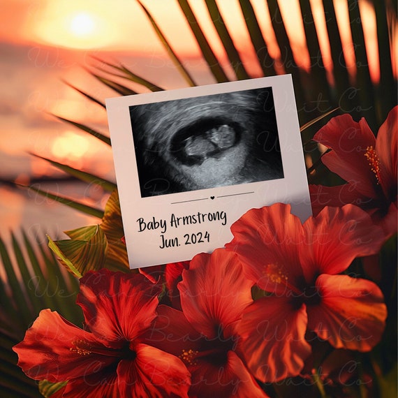 Hawaiian Beach Baby Announcement Digital, Summer Pregnancy Announcement, Custom Gender-Neutral Baby Announcement, Floral Hibiscus, Soc Media