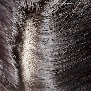 May include: Close-up of a dark brown human hair wig with a lace closure. The lace closure is a thin, transparent material that allows for a natural-looking hairline.
