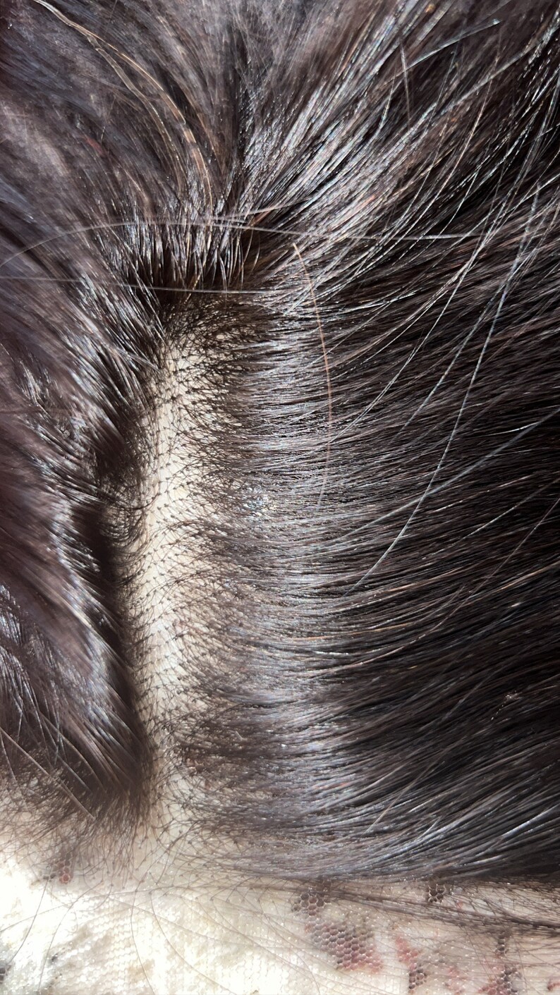 May include: Close-up of a dark brown human hair wig with a lace closure. The lace closure is a thin, transparent material that allows for a natural-looking hairline.