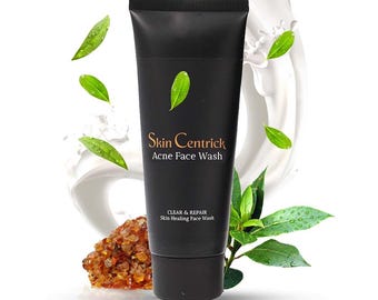 Gentle Acne Face Wash for Oily Skin | Daily Cleanser for Balanced Complexion