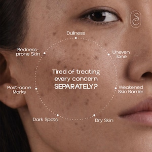 Niacinamide Serum for Acne, Pores, Oil Control | Brightening, Smooth Skin Tone image 3