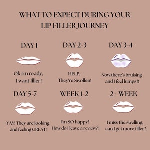 Lip filler journey card