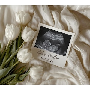 May include: A still life featuring white tulips and a sonogram photo. The sonogram is in a white frame with the text "Baby Miller APRIL 2026". The flowers and photo rest on a cream-colored fabric.