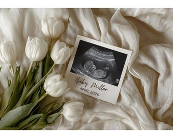 Mall för graviditetsmeddelande: Redigerbart avslöjande för sociala medier, neutralt babymeddelande för Instagram eller Facebook, tulpanblommor (digitalt)