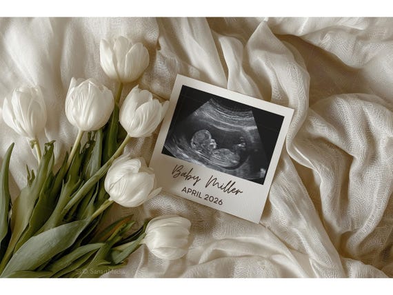 Pregnancy Announcement Template: Editable Social Media Reveal, Neutral Baby Announce for Instagram or Facebook, Tulip Flowers (Digital)