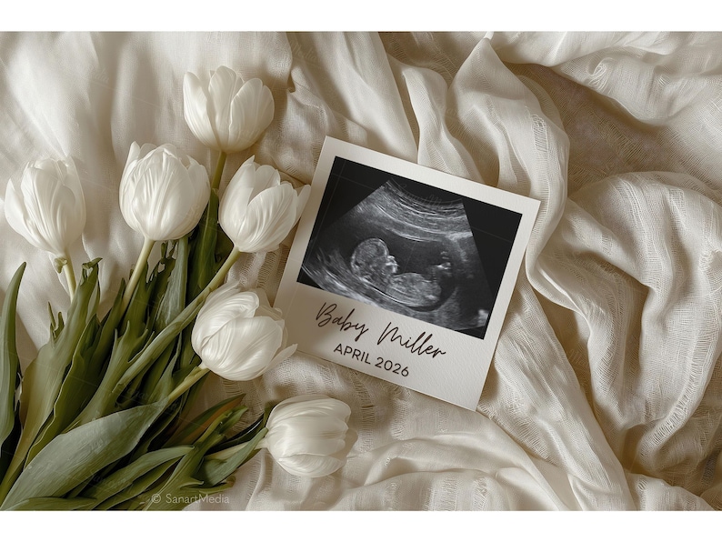 May include: A still life featuring white tulips and a sonogram photo. The sonogram is in a white frame with the text "Baby Miller APRIL 2026". The flowers and photo rest on a cream-colored fabric.