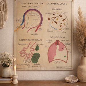 Manifesto didattico, scuola - tabella scientifica ROSSIGNOL - anni '50 - '60, Scambio gassoso - tubercolosi, Respirazione.