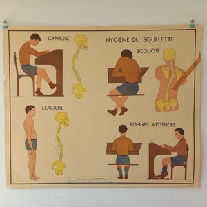 Educatief, schoolplaat - ROSSIGNOL wetenschapstafel - jaren 50 - 60, Skelethygiëne, Spieren.