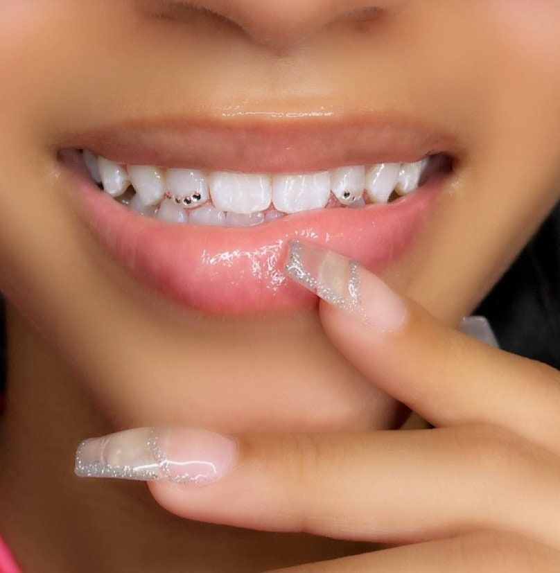 Great Fitting Retainer With Diamonds Customization or Logo.1 Top or Bottom. Have a Design Send a