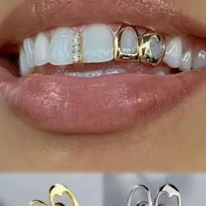 May include: Close-up of a person's smile, showcasing gold and diamond dental grills. The grills feature heart and star designs. The lips are a natural pink color.