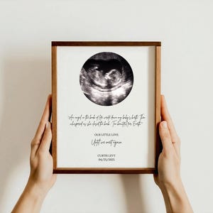 Digital Miscarriage Keepsake, Baby Loss Memorial Art, Pregnancy Loss Gift, Custom Ultrasound or Line Drawing, Infant Loss Printable