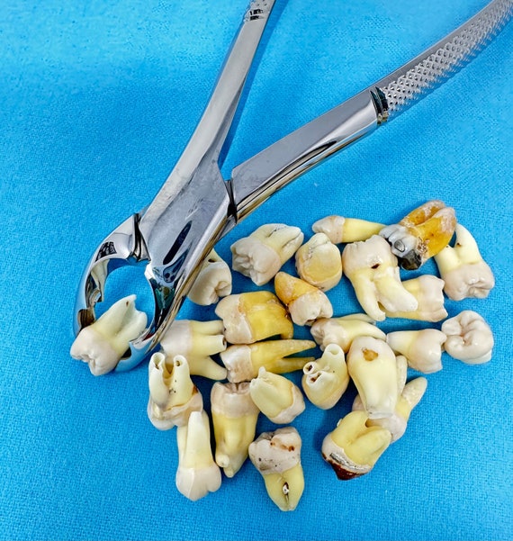 100% REAL human teeth, STERILIZED, for jewelry, for dental students, 5 count of human POSTERIOR teeth, B Grade molar and bicuspid random