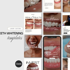 Puede incluir: Una colección de plantillas digitales para redes sociales sobre servicios de blanqueamiento dental, con varios primeros planos de sonrisas, textos superpuestos como 'Real Results' y 'Teeth Whitening', y una maqueta de smartphone con una interfaz de reserva.