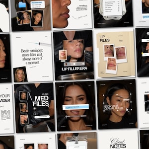 Botox Filler Instagram Post Templates Medspa Social Media Posts for Nurse Injectors, Aesthetic Clinics