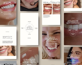 Plantillas de Instagram para blanqueamiento dental, publicaciones e historias de dentistas: Plantillas editables de Canva