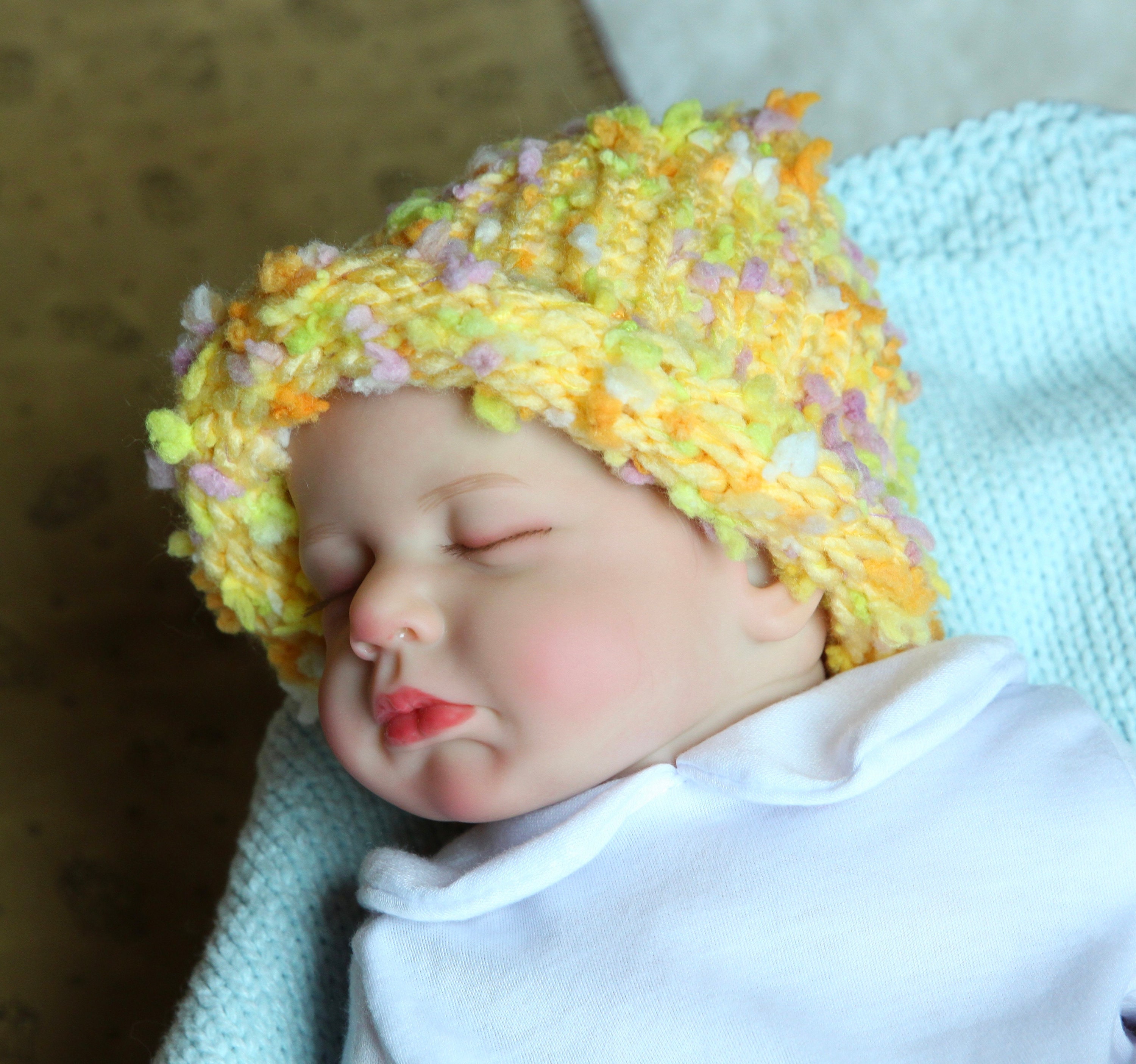 Ojos Por Que Se Pone Amarillo Un Bebe Ojos Amarillentos Xq Los