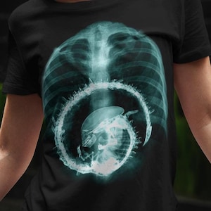 May include: A black t-shirt featuring a graphic print of an x-ray image of a human torso with a spiral design in the stomach area.