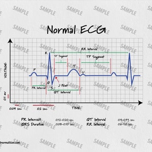 Descarga digital de conceptos básicos de EKG, tamaño carta