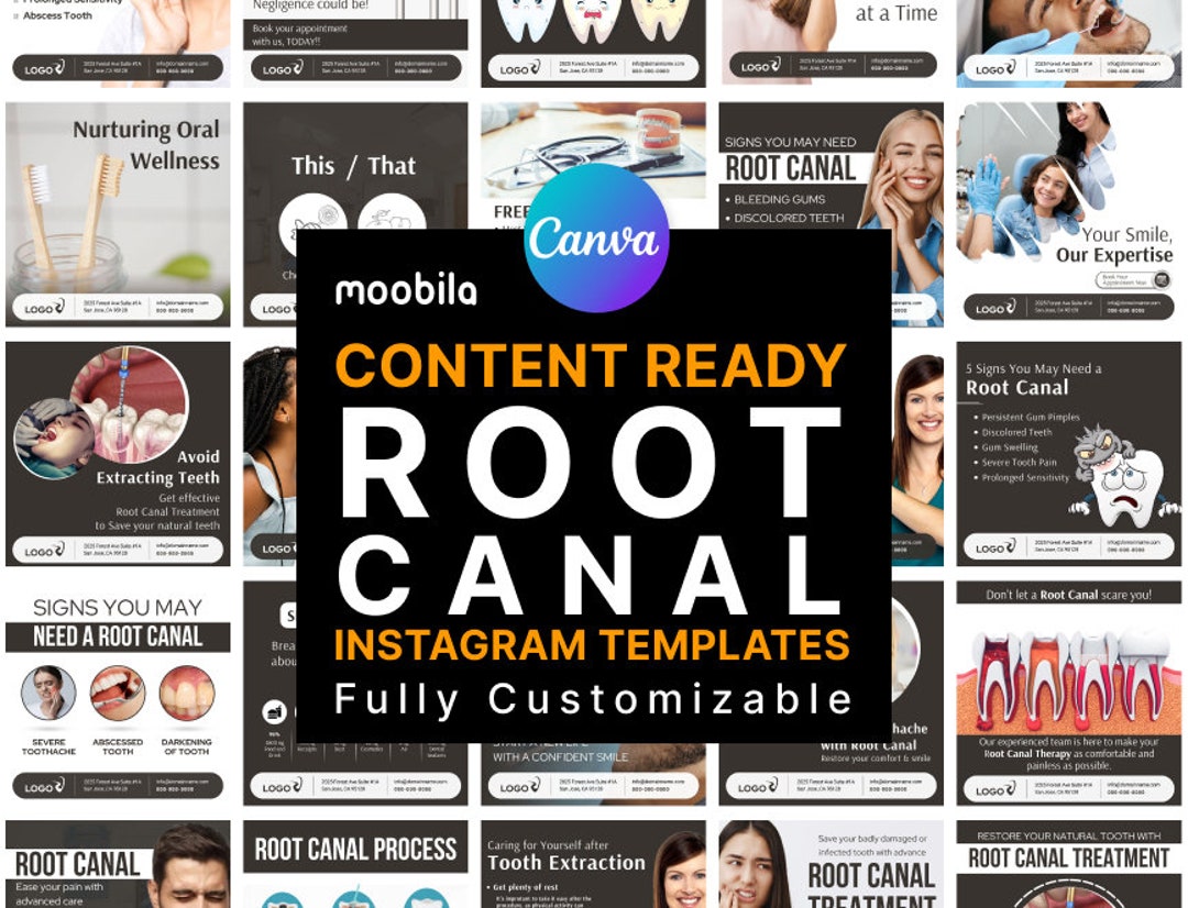 Root Canal Instagram Templates: Dental Posts, Canva Designs - Etsy