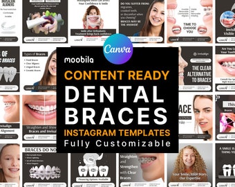 Dental Braces Instagram Templates | Braces Instagram Posts | Orthodontist Instagram Branding | Teeth Care Template | Canva Braces Posts