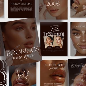 Botox Filler Instagram Vorlagen | Ästhetische Medspa Instagram-Vorlagen | Krankenschwester Injektion Social Media | Lip Filler Instagram Post