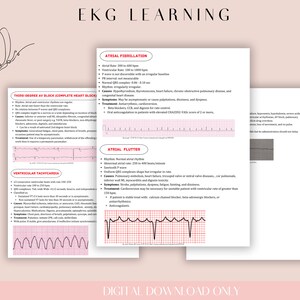 EKG Dysrhythmia Interpretation PDF EKG Study Guide | Interpretation & Common Dysrhythmias | Nursing Notes | Digital Download Only