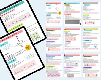 EKG Basics for Nurses and Nursing Students | ECG Interpretation & Common Dysrhythmias | Nursing Notes | Digital Download