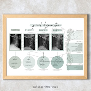 Poster spinale degeneratie pdf-download