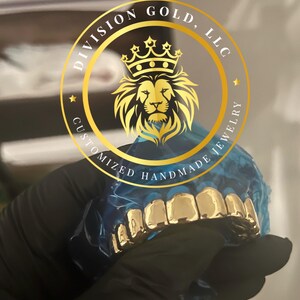 Handmade CUSTOM Gold Grillz Solid NPG Dental NP Gold grills Perm Cut Division Gold Custom Teeth Caps bild 9