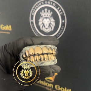 Handmade CUSTOM Gold Grillz Solid NPG Dental NP Gold grills Perm Cut Division Gold Custom Teeth Caps bild 4
