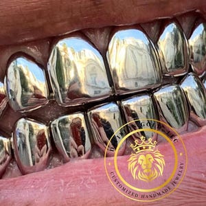 May include: Close-up of a set of shiny, silver-colored dental grills. The grills are custom-made and cover the teeth, reflecting light. The image includes a logo with a lion and the text "DA KING GOV LLC CUSTOMIZED HANDMADE JEWELRY."