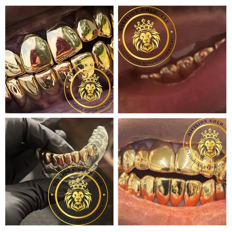 May include: Close-up shots of gold teeth grills. The grills are highly polished and reflect light. The images include the Division Gold, LLC logo with a lion's head and the text "CUSTOMIZED HANDMADE JEWELRY".