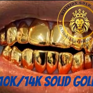 May include: Close-up of a mouth with a full set of gold teeth. The teeth are a bright, shiny gold color. The text "10K/14K SOLID GOLD" is displayed in blue at the bottom. A gold logo with a lion's head is in the upper right corner.