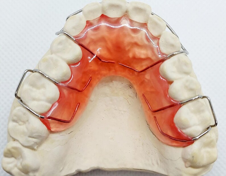 Custom Orthodontic Upper and Lower Hawley Retainers Etsy UK