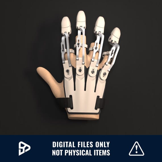 3d Printed Hand Prosthetic