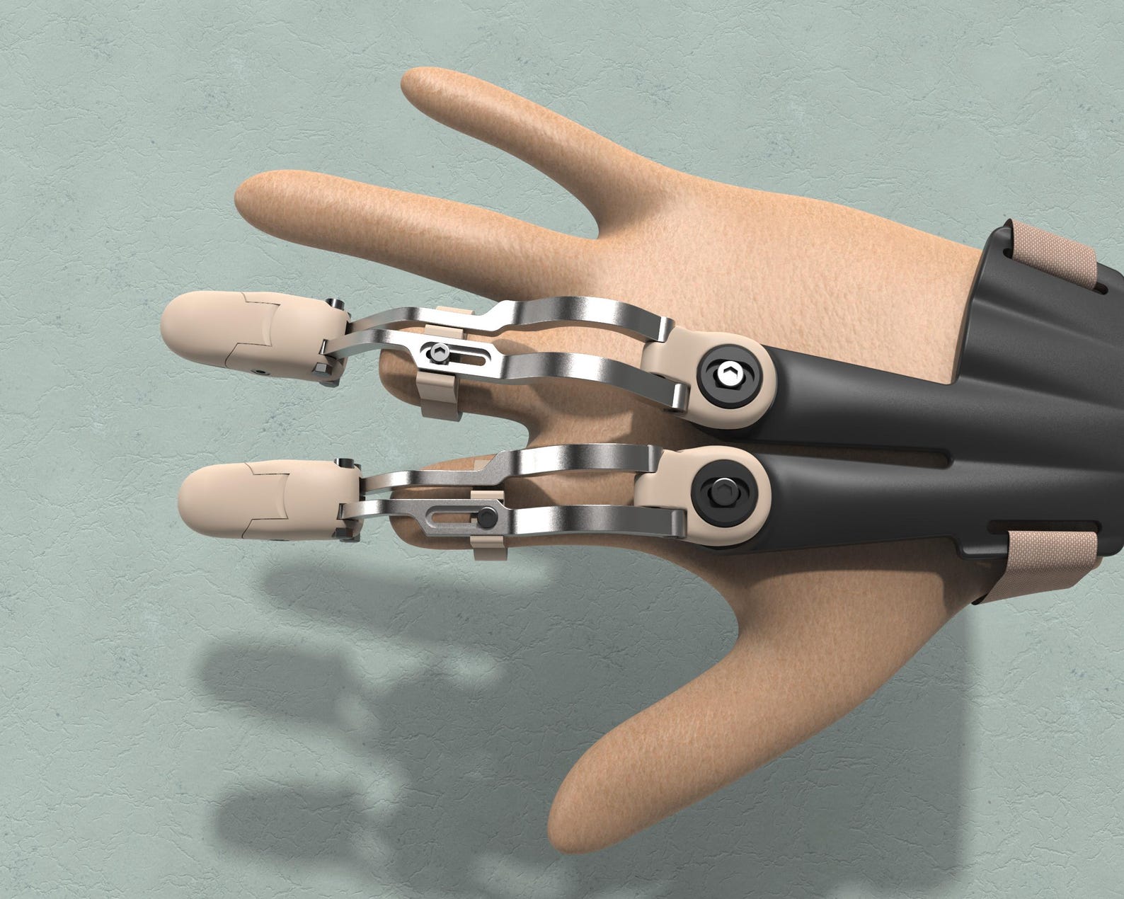 3D Printed Mechanical Prosthetic Hand STL File: DIY Assistive Device ...