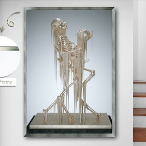 Verpackung Bronze Skelette, Bronze-Skelett-Kunst, umarmt Skulptur, einzigartige Bronzefiguren, skulpturale Umarmung