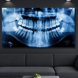 Stampa su tela di denti dentali, poster di clinica odontoiatrica, regalo per dentista, odontoiatria, stampa su tela di denti per studio dentistico