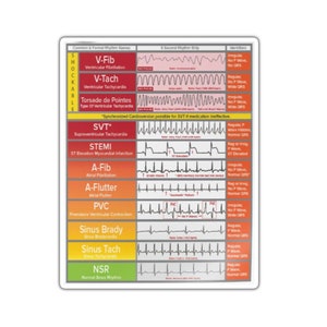 Sticker ECG-interpretatie - Med Student Gift, Cardiologie, ECG, Leermiddel, Educatief hulpmiddel, Med School, Cardiovasculair systeem