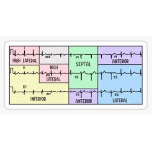 May include: A diagram of an electrocardiogram (ECG) showing the different leads and their corresponding locations on the heart. The leads are labeled I, II, III, aVR, aVL, aVF, V1, V2, V3, V4, V5, and V6. The heart is divided into three sections: high lateral, septal, and anterior. The diagram is a helpful tool for understanding the different parts of the heart and how they are represented on an ECG.