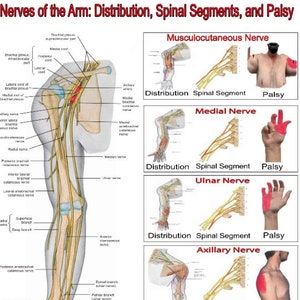 以下が含まれることがあります： 腕の神経の分布、脊髄セグメント、および麻痺を示す図。図には、腕の神経、筋肉、骨のイラストと、神経損傷の影響が含まれています。