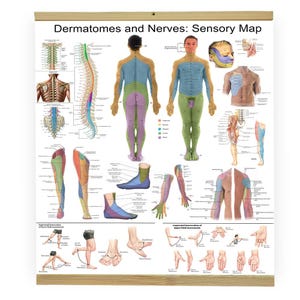 May include: A medical poster titled "Dermatomes and Nerves: Sensory Map" with anatomical illustrations. The poster features diagrams of the human body, spinal cord, and limbs, color-coded to represent nerve pathways. The poster is mounted on a wooden frame.