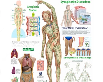 Lymphatic System Poster – Anatomy, Disorders & Drainage | Medical Chart (Digital Download)