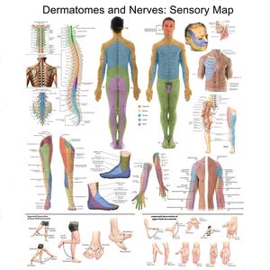 Può includere: Illustrazione medica dettagliata intitolata "Dermatomi e nervi: Mappa sensoriale". L'immagine presenta diagrammi del corpo umano, tra cui il midollo spinale, il busto e gli arti, con aree codificate a colori che rappresentano i dermatomi e i percorsi nervosi.