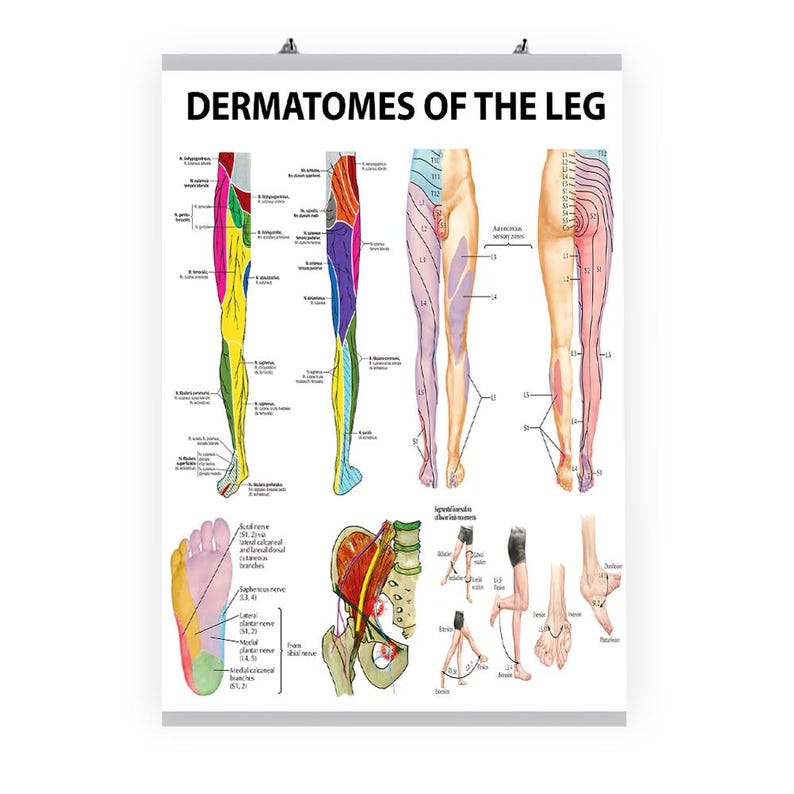 Leg Dermatomes Poster Nerve Distribution Chart Medical Anatomy Art Leg Dermatomes Poster Nerve Distribution Chart Medical Anatomy Art