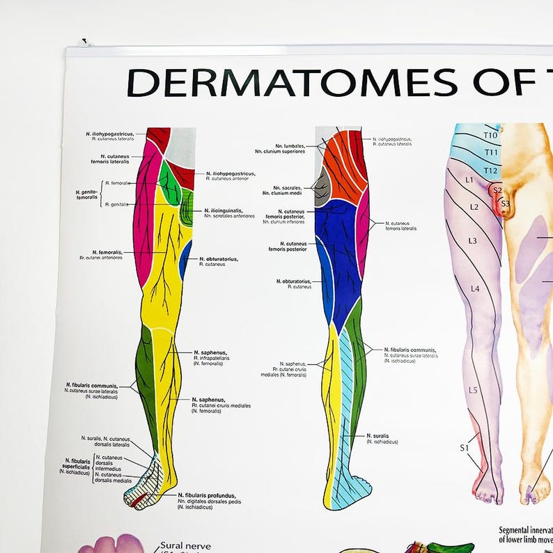 Leg Dermatomes Poster Nerve Distribution Chart Medical Anatomy Art 