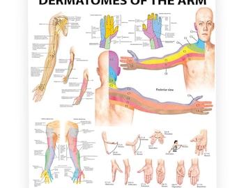 Poster dermatomes du bras - carte nerveuse, illustration de l'anatomie
