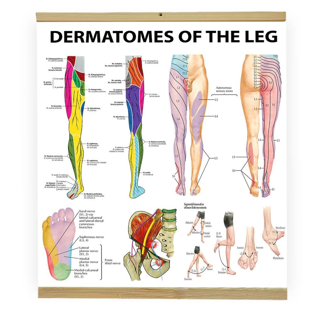Dermatomes of the Leg Poster – Anatomy Chart for Physiotherapy