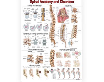 Tabella Anatomica Dei Disturbi Della Colonna Vertebrale - Poster 50x66cm Con Illustrazioni Dettagliate - Strumento Medico Educativo - 4